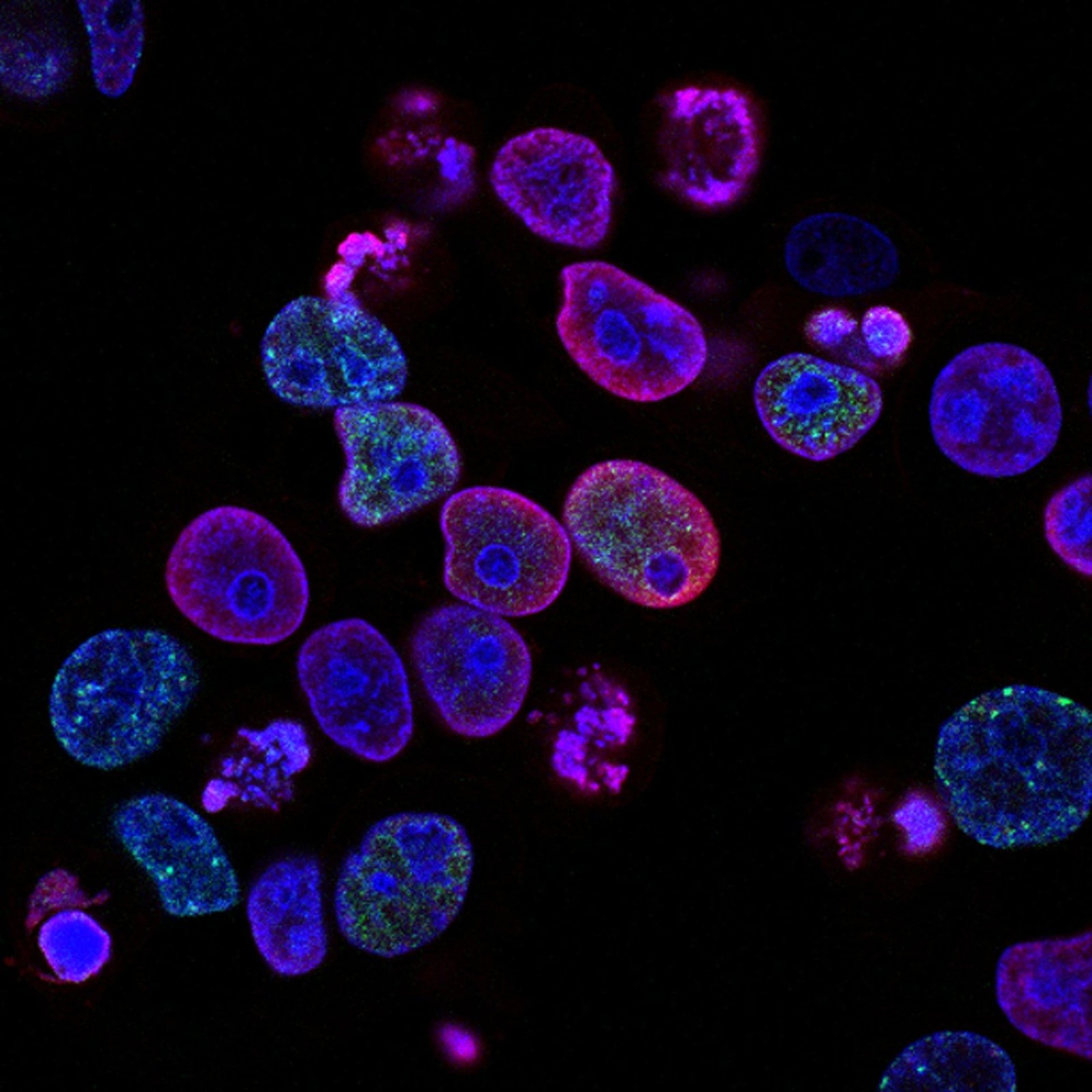 Microscopic fluorescent view of cells with blue nuclei and pink outlines